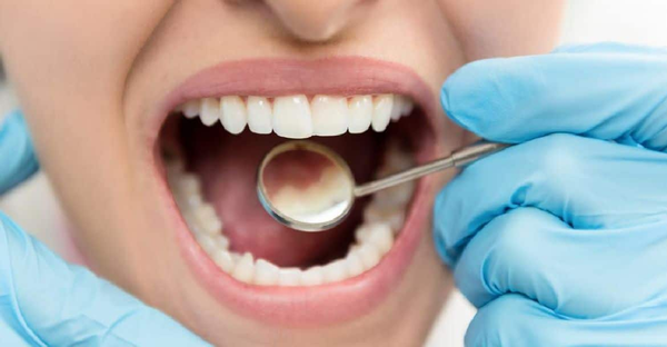 Detail zubů paní u zubaře